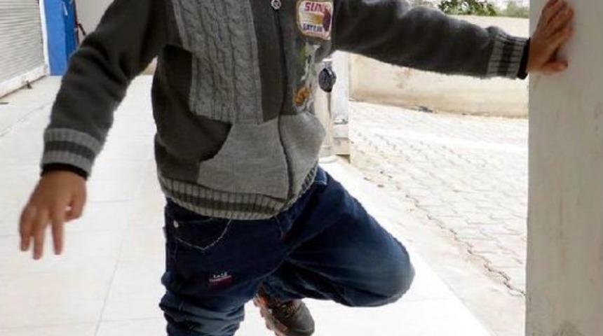 Reyhanlı'da 1500 Suriyeliye Protez Kol Ve Bacak Takıldı