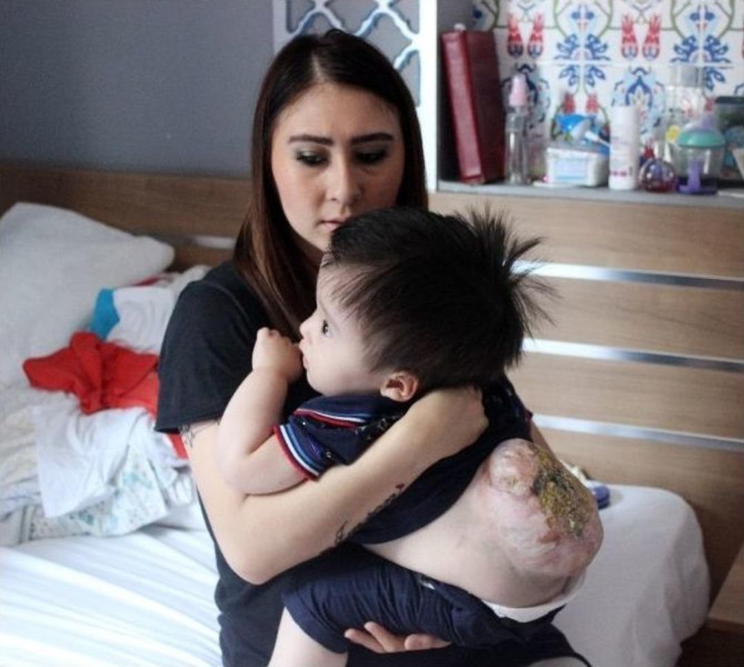 (&ouml;zel Haber) Minik İmran, Sırtındaki Urla Yaşam M&uuml;cadelesi Veriyor