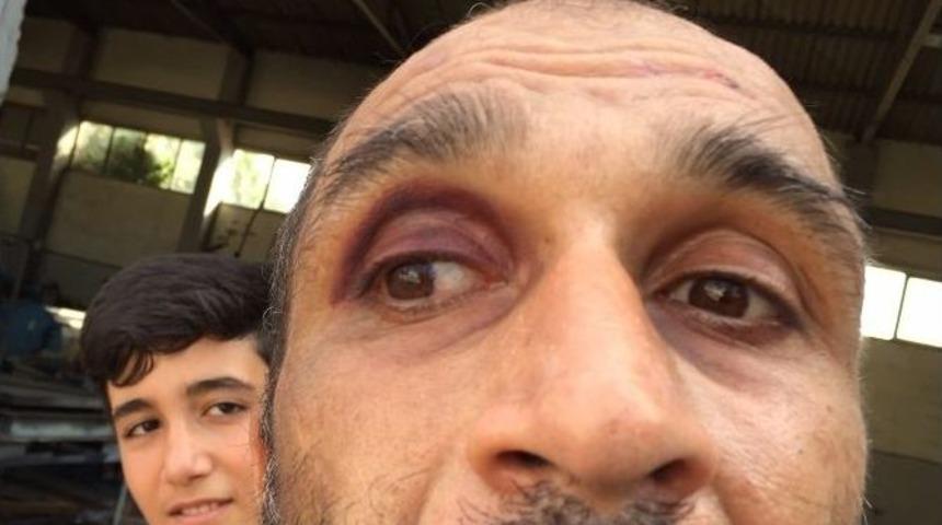 Bakım Merkezindeki Hasta Darp Raporu Aldı