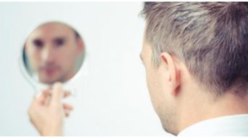 Sa&ccedil; D&ouml;k&uuml;lmesinin Altında Farklı Nedenler Var