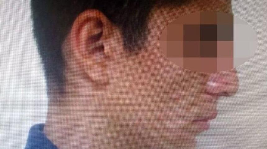 Y&uuml;z&uuml;ndeki Yara İzi Hırsızı Ele Verdi