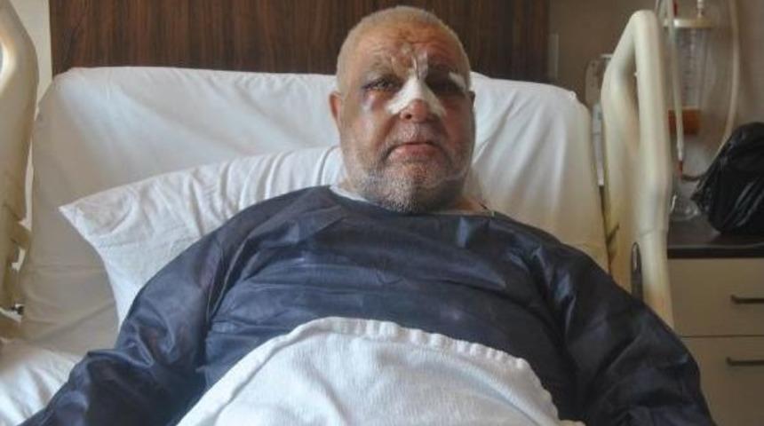 Y&uuml;z&uuml;nde Kırılmadık Kemik Kalmadı