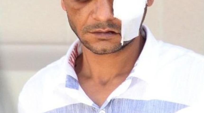 Babasını Darp Edip Yeğenini Bı&ccedil;aklayan Şahsa Yakınlarından Meydan Dayağı