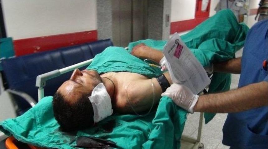 Pompalı T&uuml;fekle Vurdular, Yetmedi Kulağını Kestiler