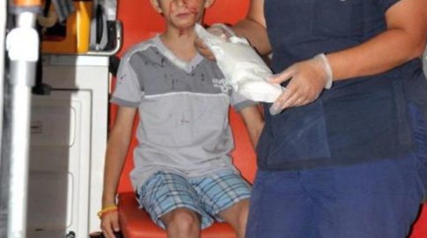 Otomobil &Ccedil;arptığı Uzman Onbaşı Yaralandı