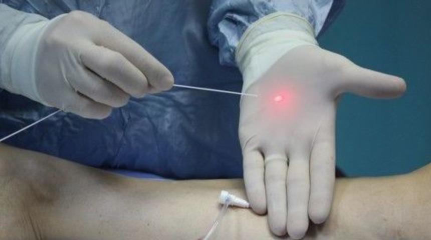 Lazer Teknolojisiyle Varis Tedavisi