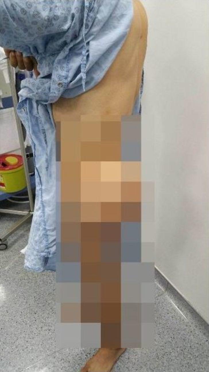 (özel Haber) Tümör Nedeniyle 6 Yıl Boyunca Uyuyamadı G4