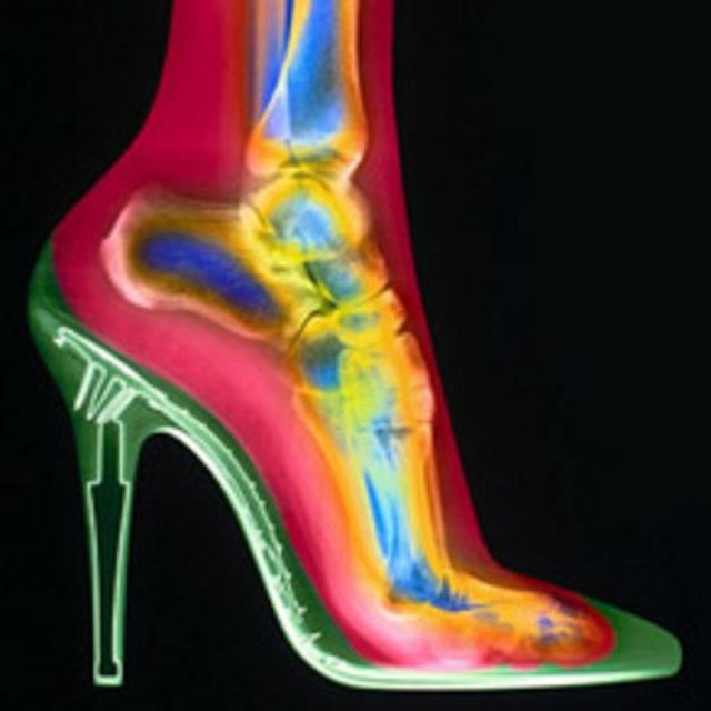 Y&uuml;ksek Topukla Rahat Ayaklar! 1