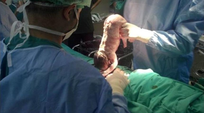 Gevaş&rsquo;ta İlk Sezaryen Doğum Ger&ccedil;ekleştirildi