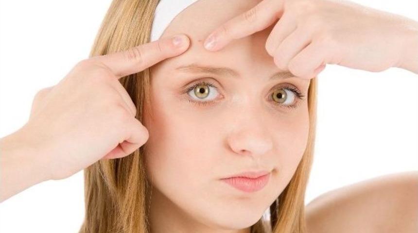 Akne Sorunu Kişiye G&ouml;re Değişiyor!