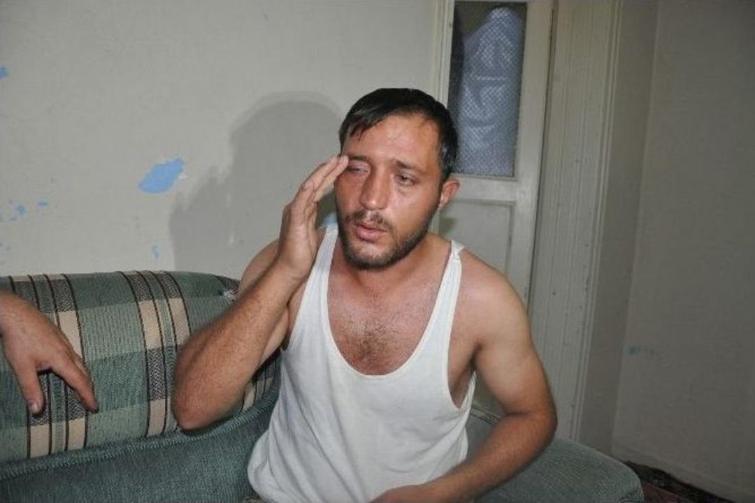 Işid&rsquo;in Kimyasal Bombasına Maruz Kalan Suriyeli Aile