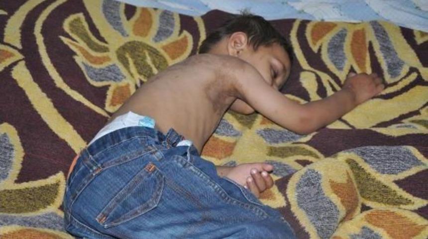 Işid'in Bombasıyla Yaralanan Suriyeli Aile İneg&ouml;l&rsquo;E Geldi