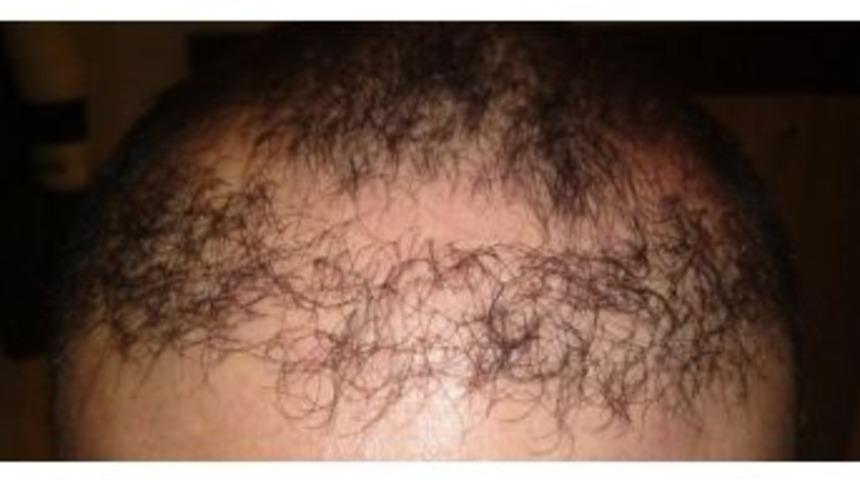 Merdiven Altı Sa&ccedil; Ekim Merkezi Mağduru Şikayet&ccedil;i Oldu