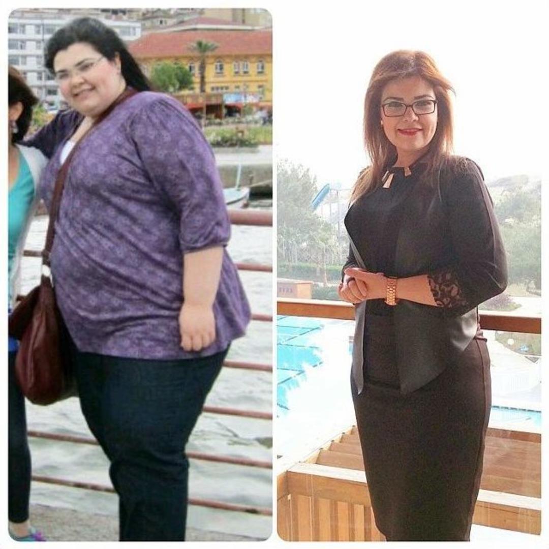 (&ouml;zel Haber) Hastalarıyla Birlikte Kilo Verdi