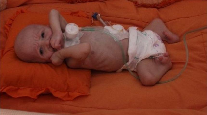 Aslan Sendromlu Mustafa Kemal Bebek Kurtarılamadı