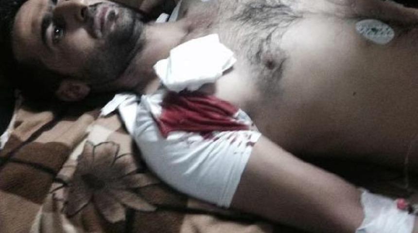 Yeğeni Tarafından Evinin &Ouml;n&uuml;nde Vuruldu