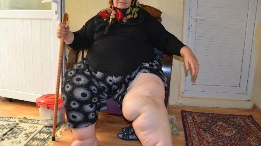 (&ouml;zel Haber) 171 Kiloluk Necla Teyzenin Yardım &Ccedil;ığlığı