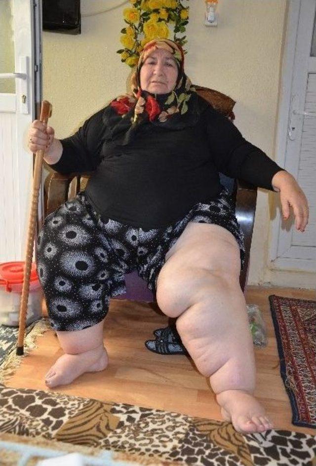 (&ouml;zel Haber) 171 Kiloluk Necla Teyzenin Yardım &Ccedil;ığlığı 2