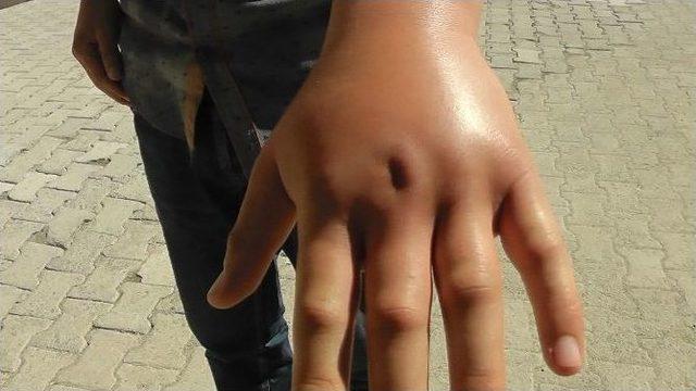 Kulu’da Acemi Kasaplar Hastanelik Oldu 2