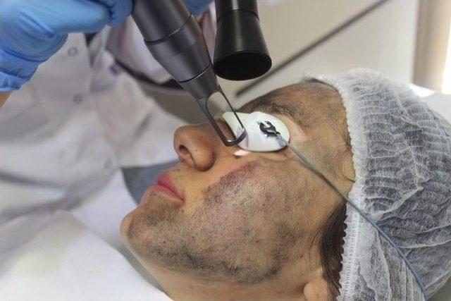 Güneş Lekelerinden “maske Peeling” İle Kurtulun