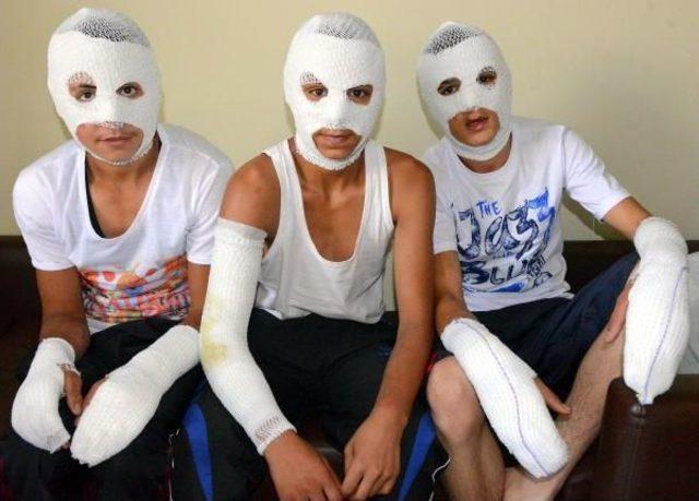 Torpido Gözündeki Çakmak Gazı Patladı: 3 Çocuk Yaralı 2