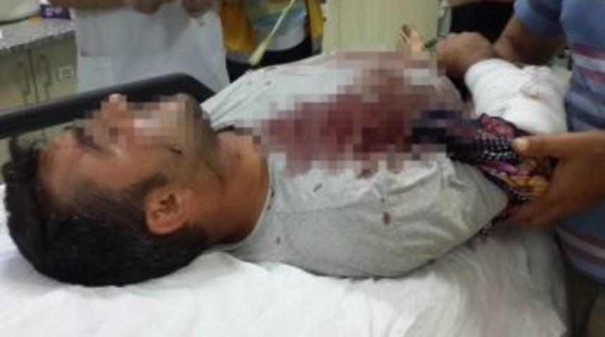 Kabak Keserken Kendini Kesti