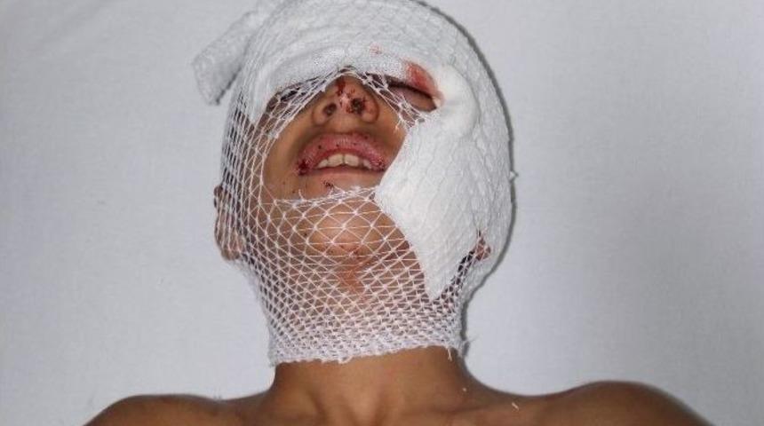 Samsun&rsquo;da K&ouml;pek Dehşeti