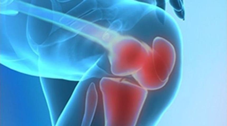 Protez Operasyonu Sonrası Fizik Tedavinin &Ouml;nemi