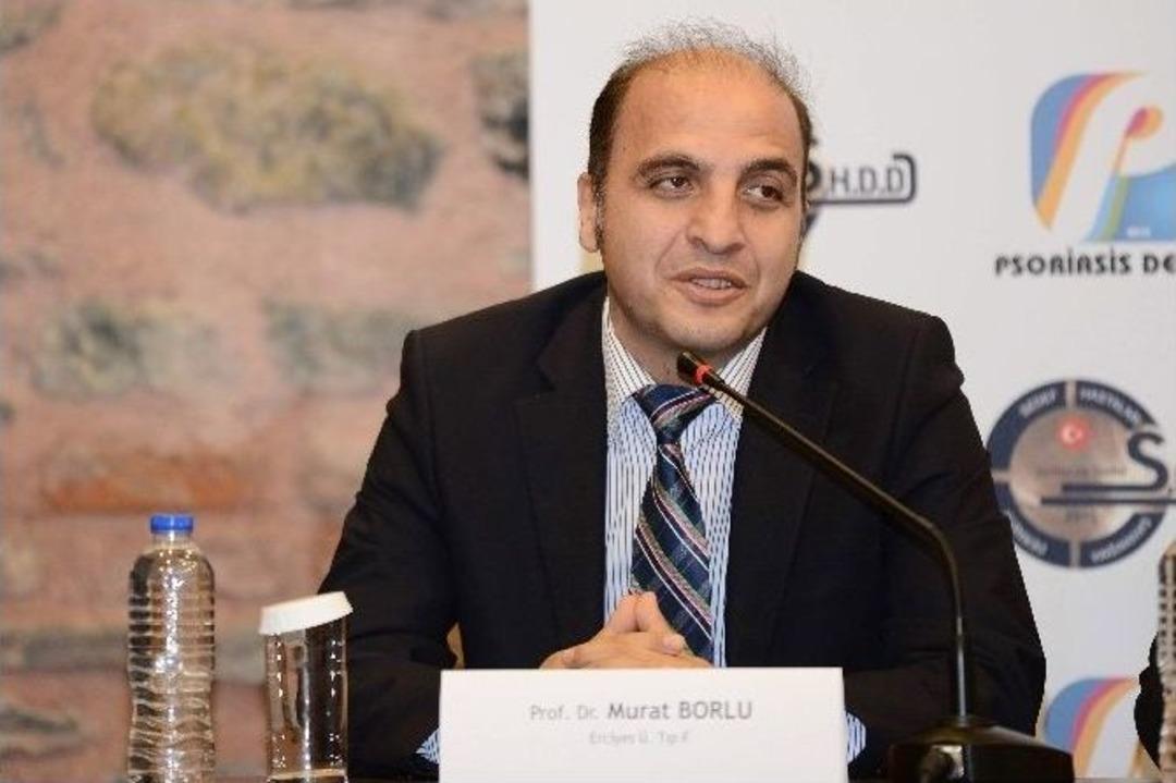 Uzman G&ouml;r&uuml;ş&uuml;: "sedef Hastalığı Bulaşıcı Değil"