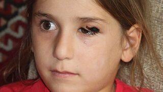 Sivas'taki Karadoruk köyünde şarbon paniği! Temas edenlerin vücudunda yaralar çıktı