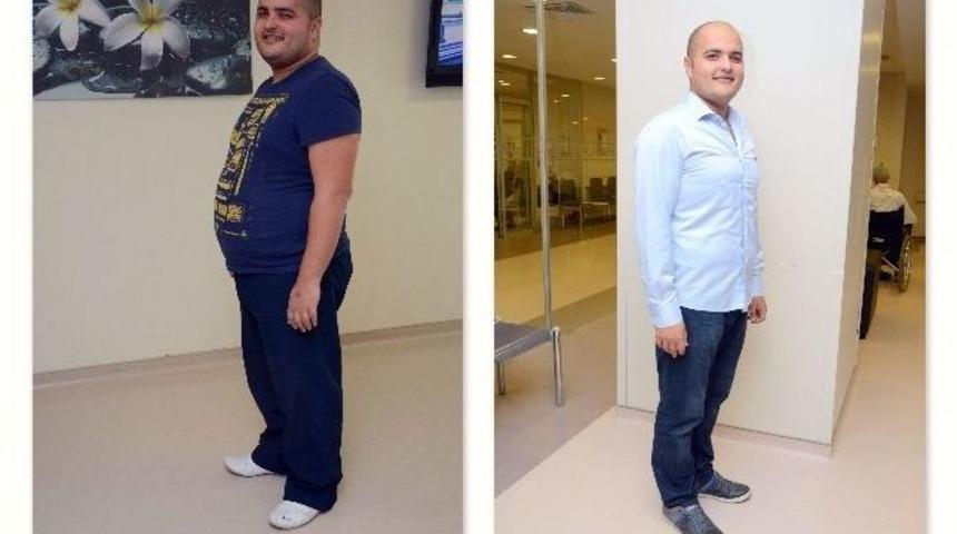 Obezite Cerrahisiyle Yeni &rsquo;beden&rsquo;lerine Kavuştular