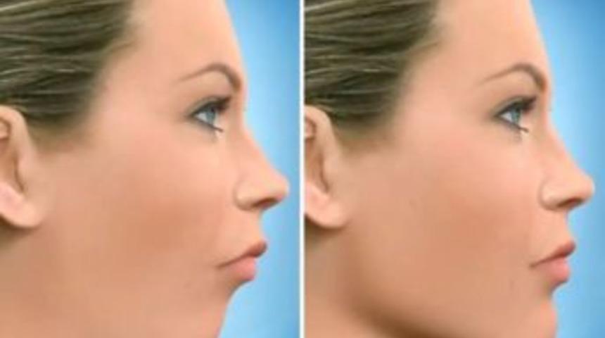 &Ccedil;ene Ucu Estetiğinde Devrim