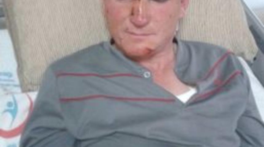 Balkondan D&uuml;şen İş&ccedil;i Yaralandı