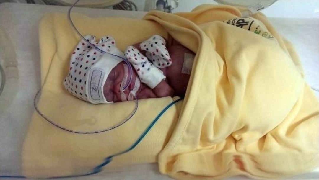 Bursa&rsquo;da Yaşamaz Denilen Parmak Bebek G&ouml;renleri Şaşırtıyor