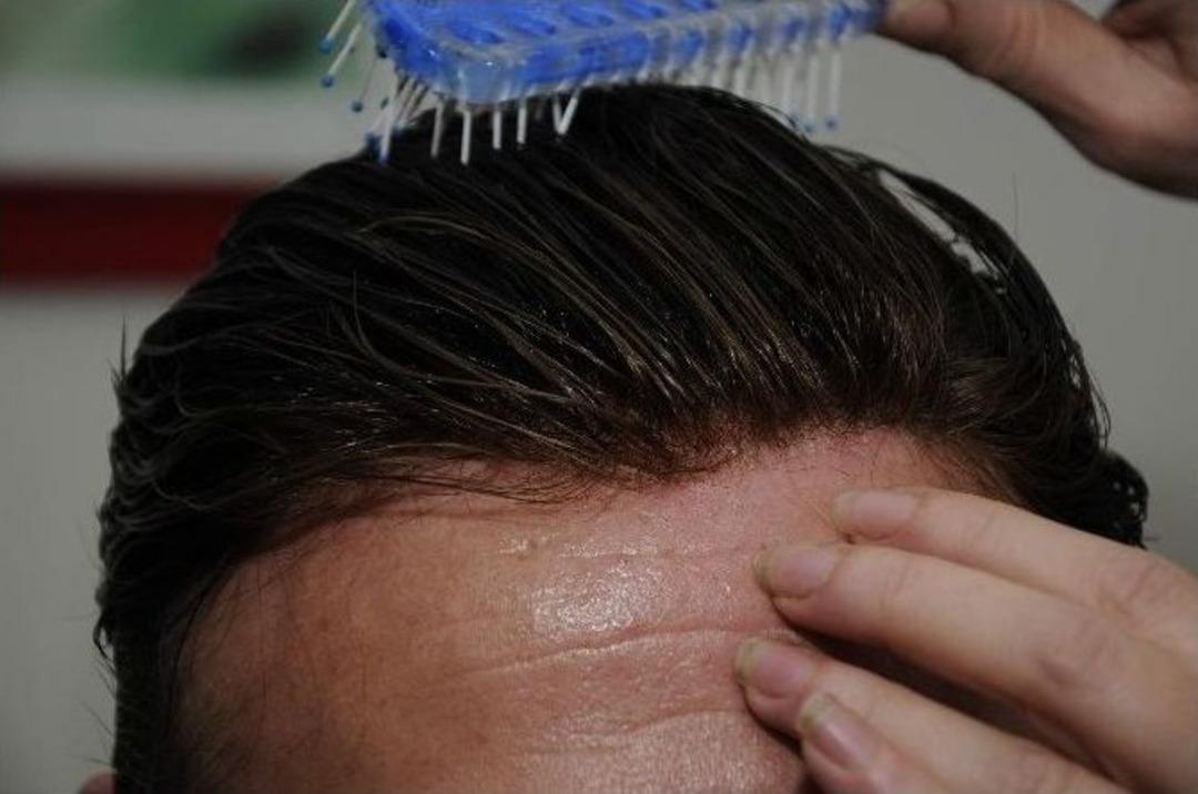 Kellerin Umudu Protez Sa&ccedil;