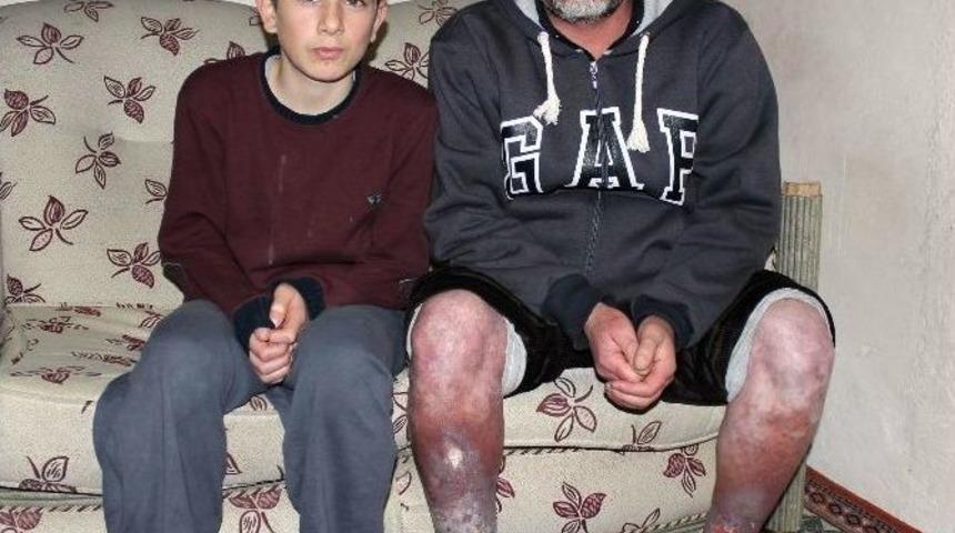 (&ouml;zel Haber) Tedavi Olamazsa Ayakları Kesilecek