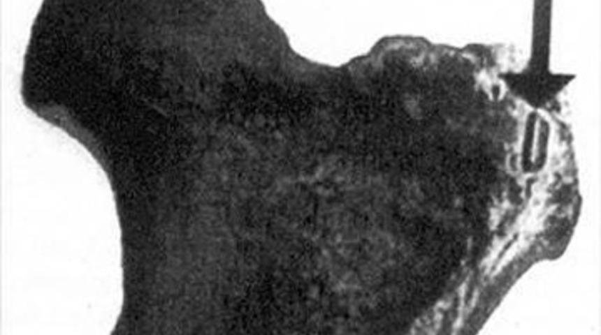 8 ASIRDIR &Ccedil;&Uuml;R&Uuml;MEYEN CESET