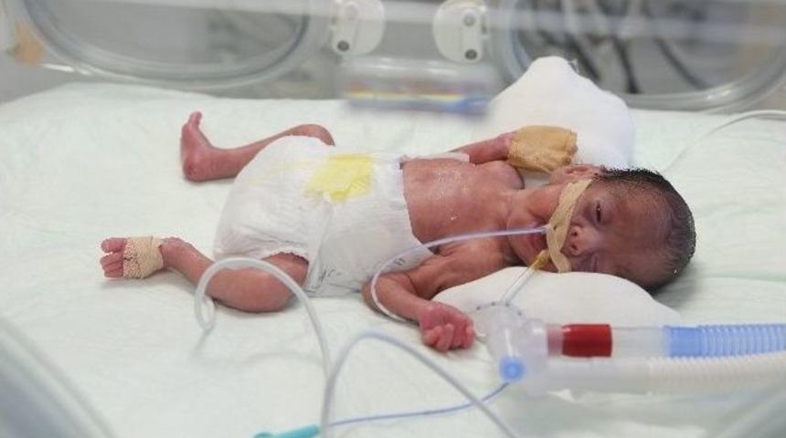 750 Gram Bebeğin Kalbindeki Delik Ameliyatsız Y&ouml;ntemle Kapatıldı