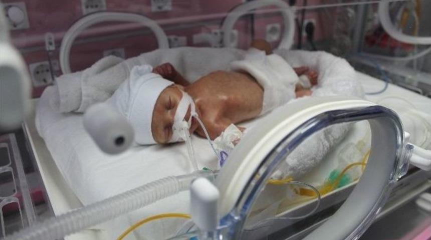Yenidoğan Bakım &Uuml;nitesinde Premat&uuml;re Bebekler Can Buluyor