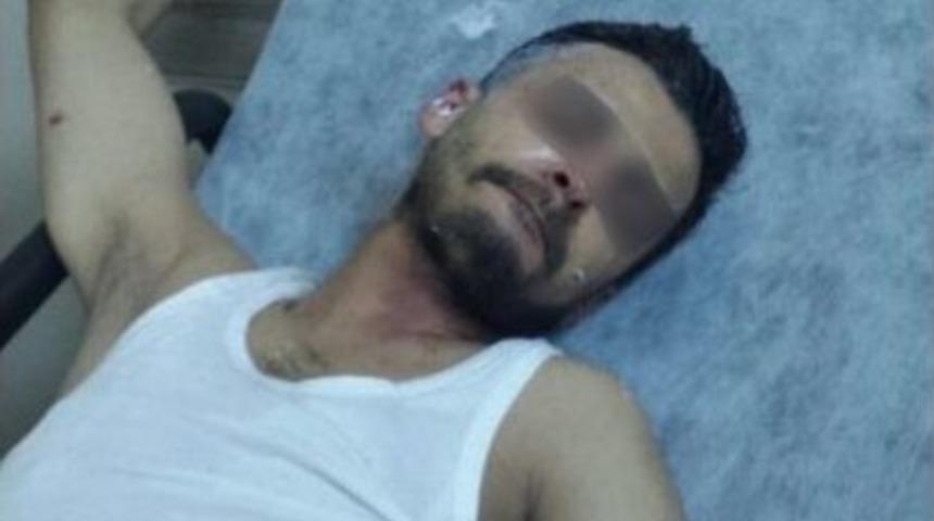 Ara&ccedil; Kundaklarken Kendini Ve Sevgilisini Yaktı