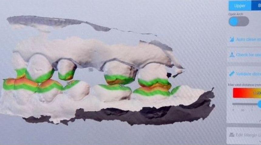 Estetik Dişte Dijital Devir