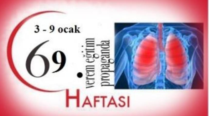 İl Sağlık M&uuml;d&uuml;rl&uuml;ğ&uuml; Veremle İlgili Bilgi Notu Yayımladı