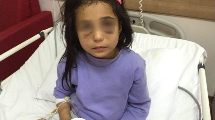 &Uuml;vey Annesinin D&ouml;vd&uuml;ğ&uuml; Kız &Ccedil;ocuğu Devlet Korumasına Alınıyor