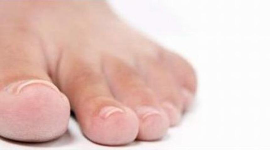 Tırnak Batmasına Yeni &Ccedil;&ouml;z&uuml;m