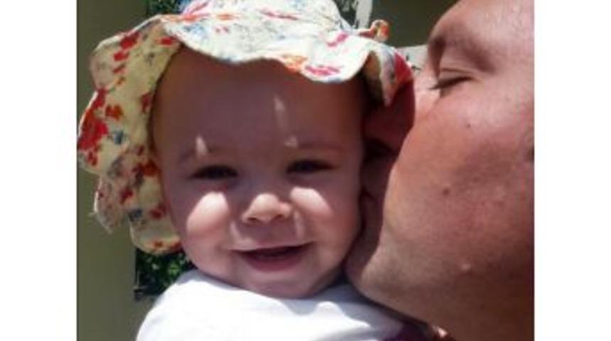 (&ouml;zel Haber) 18 Aylık L&ouml;semi Hastası Ferah Bebek, İlik Bekliyor