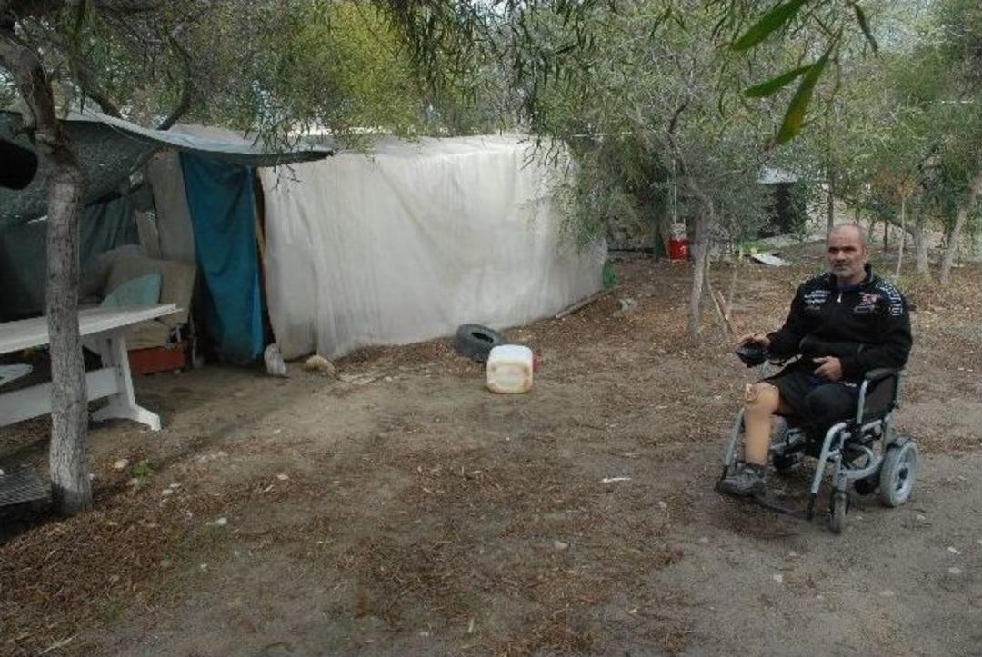 Kesik İki Ayakla &Ccedil;adırda Yaşam M&uuml;cadelesi