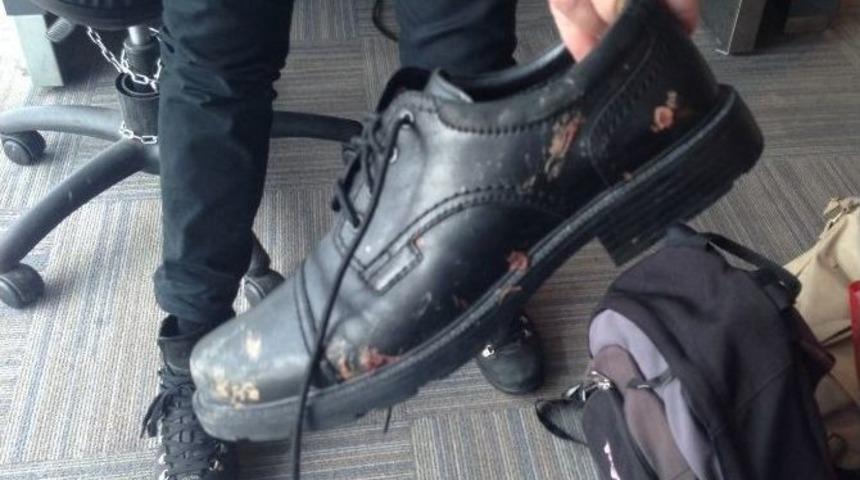 Bombalı Saldırıda Yaralanan Norveçli Turist, Ülkesine Döndü