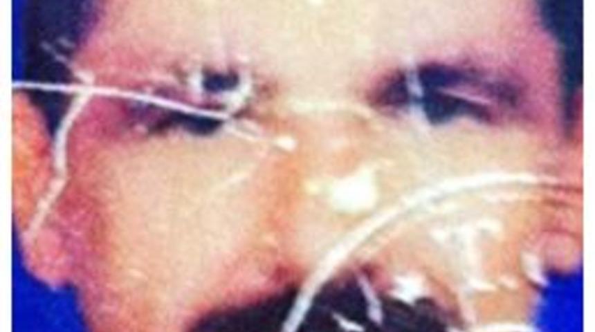 Kalbi Duran Şahıs Hastanede Hayata D&ouml;nd&uuml;