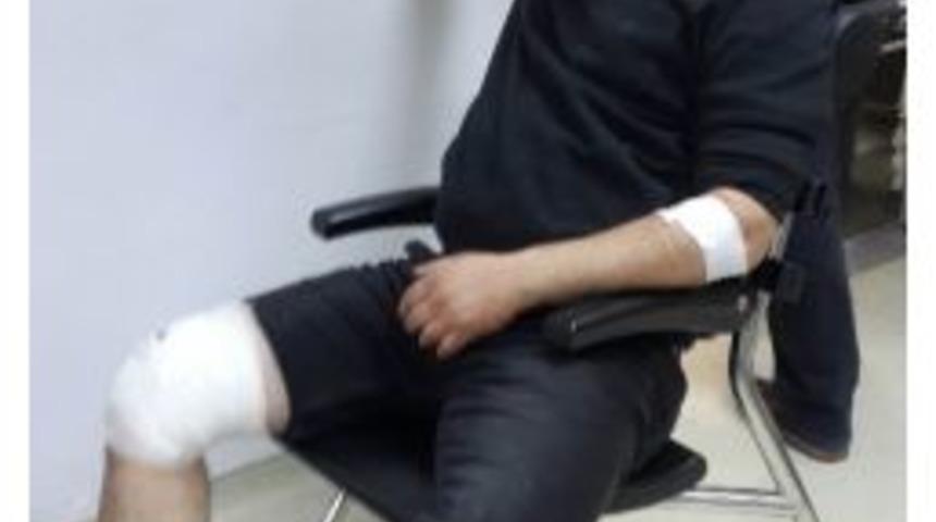 Samsun&rsquo;da Silahlı Saldırı: 1 Yaralı