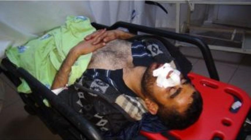 Motosiklet S&uuml;r&uuml;c&uuml;s&uuml; Hindiye &Ccedil;arpmamak İ&ccedil;in Kaza Yaptı